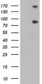 FGFR2 Antibody in Western Blot (WB)