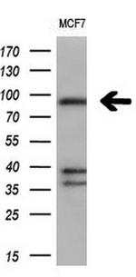 FGFR2 Antibody in Western Blot (WB)