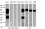 FGFR2 Antibody in Western Blot (WB)