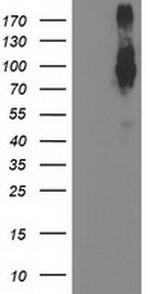 FGFR2 Antibody in Western Blot (WB)