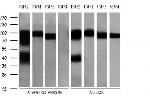 FGFR2 Antibody in Western Blot (WB)