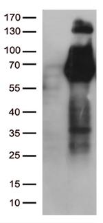 FGFR2 Antibody in Western Blot (WB)