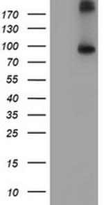 FGFR2 Antibody in Western Blot (WB)