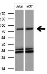 FGFR2 Antibody in Western Blot (WB)