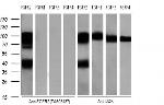 FGFR2 Antibody in Western Blot (WB)