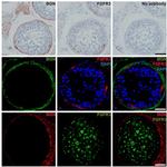 FGFR3 Antibody in Immunohistochemistry (IHC)