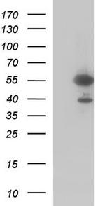 FGG Antibody in Western Blot (WB)