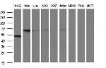 FGG Antibody in Western Blot (WB)