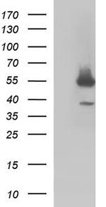 FGG Antibody in Western Blot (WB)