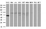 FGG Antibody in Western Blot (WB)