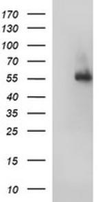 FGG Antibody in Western Blot (WB)