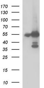 FGG Antibody in Western Blot (WB)