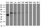 FGG Antibody in Western Blot (WB)