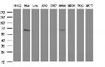 FGG Antibody in Western Blot (WB)