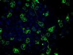 FH Antibody in Immunocytochemistry (ICC/IF)