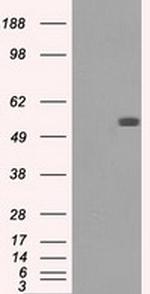 FH Antibody in Western Blot (WB)