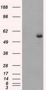 FH Antibody in Western Blot (WB)