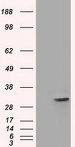 FHL1 Antibody in Western Blot (WB)