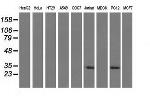 FHL1 Antibody in Western Blot (WB)