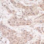 FHL2 Antibody in Immunohistochemistry (IHC)