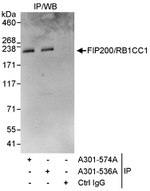 FIP200/RB1CC1 Antibody in Immunoprecipitation (IP)