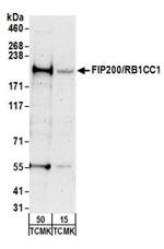 FIP200/RB1CC1 Antibody in Western Blot (WB)