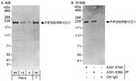 FIP200/RB1CC1 Antibody in Western Blot (WB)