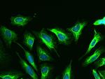 Cytokeratin 18 Antibody in Immunocytochemistry (ICC/IF)