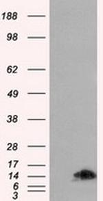 FKBP1A Antibody in Western Blot (WB)