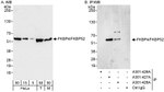 FKBP4/FKBP52 Antibody in Western Blot (WB)