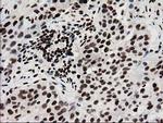 FKBPL Antibody in Immunohistochemistry (Paraffin) (IHC (P))