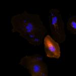 DYKDDDDK Tag Antibody in Immunocytochemistry (ICC/IF)