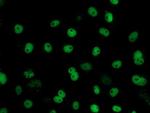 FMR1 Antibody in Immunocytochemistry (ICC/IF)