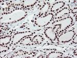 FMR1 Antibody in Immunohistochemistry (Paraffin) (IHC (P))