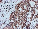 FMR1 Antibody in Immunohistochemistry (Paraffin) (IHC (P))