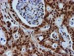 FMR1 Antibody in Immunohistochemistry (Paraffin) (IHC (P))