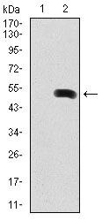 Fibronectin Antibody in Western Blot (WB)