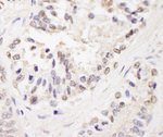 FOG1/ZFPM1 Antibody in Immunohistochemistry (IHC)