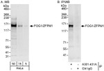 FOG1/ZFPM1 Antibody in Western Blot (WB)