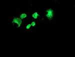 FOLH1 Antibody in Immunocytochemistry (ICC/IF)