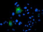 FOLH1 Antibody in Immunocytochemistry (ICC/IF)