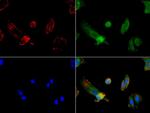 FOLH1 Antibody in Immunocytochemistry (ICC/IF)