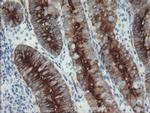 FOLH1 Antibody in Immunohistochemistry (Paraffin) (IHC (P))