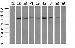 FOLH1 Antibody in Western Blot (WB)