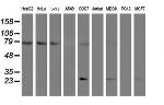 FOLH1 Antibody in Western Blot (WB)