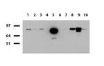 FOLH1 Antibody in Western Blot (WB)