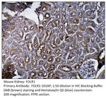 FOLR1 Antibody in Immunohistochemistry (IHC)