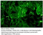 FOLR1 Antibody in Immunohistochemistry (IHC)