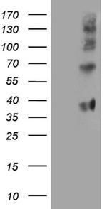 FOLR3 Antibody in Western Blot (WB)