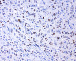 FOS Antibody in Immunohistochemistry (Paraffin) (IHC (P))